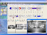 DentiMax Dental Software
