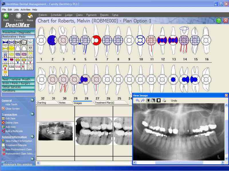 DentiMax Dental Software 06.04 Free Download